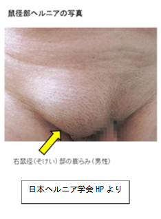へるにあ.png